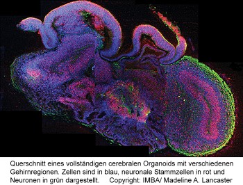 Querschnitt eines vollständigen cerebralen Organoids mit verschiedenen Gehirnregionen.